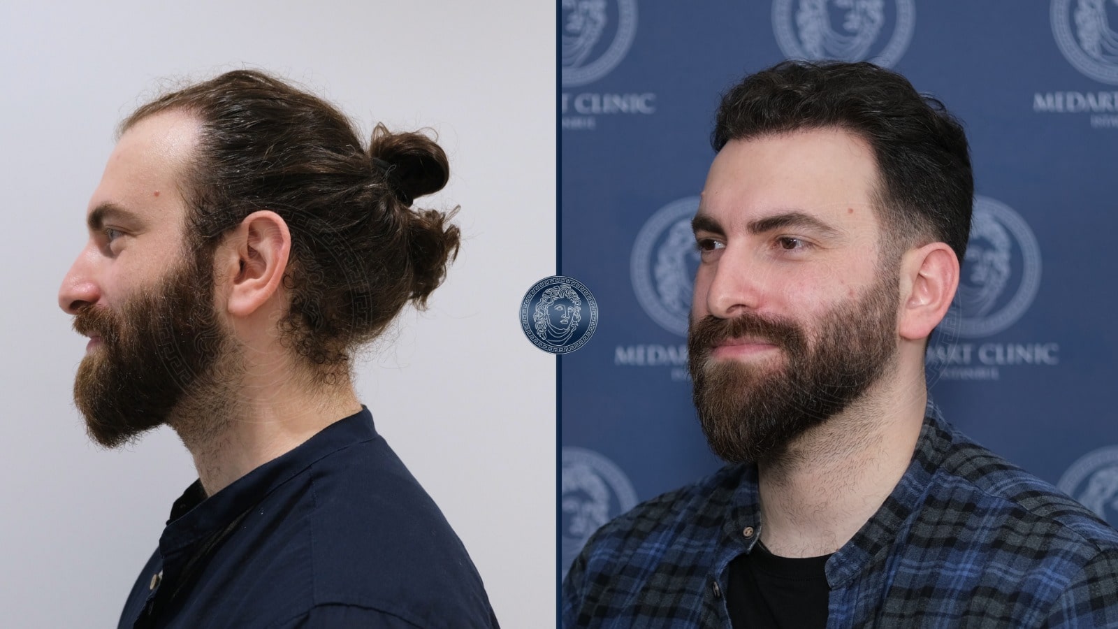 /foren/transplant/index.php/fa/67382/0/