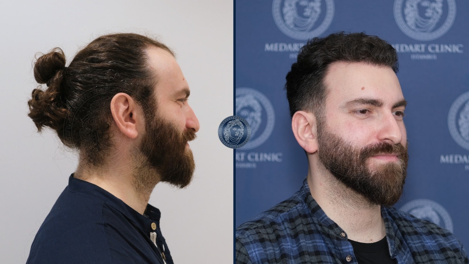 /foren/transplant/index.php/fa/67383/0/