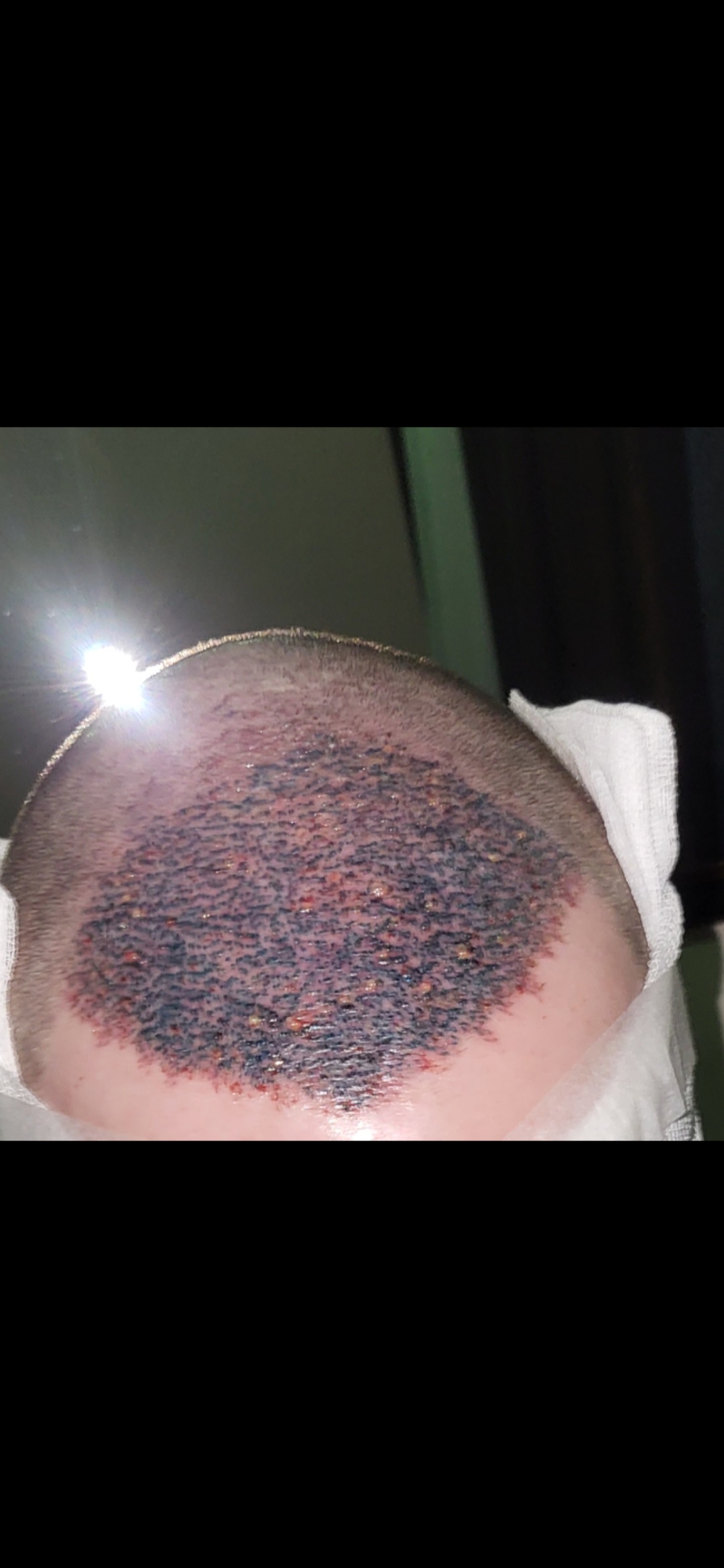 /foren/transplant/index.php/fa/67393/0/