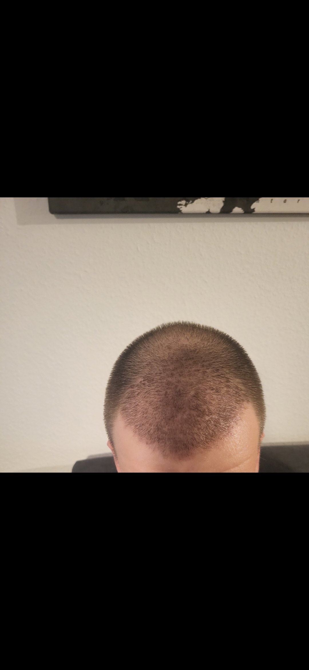 /foren/transplant/index.php/fa/67394/0/