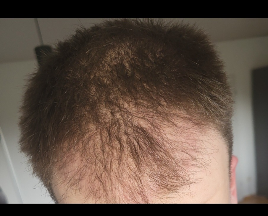 /foren/transplant/index.php/fa/67395/0/