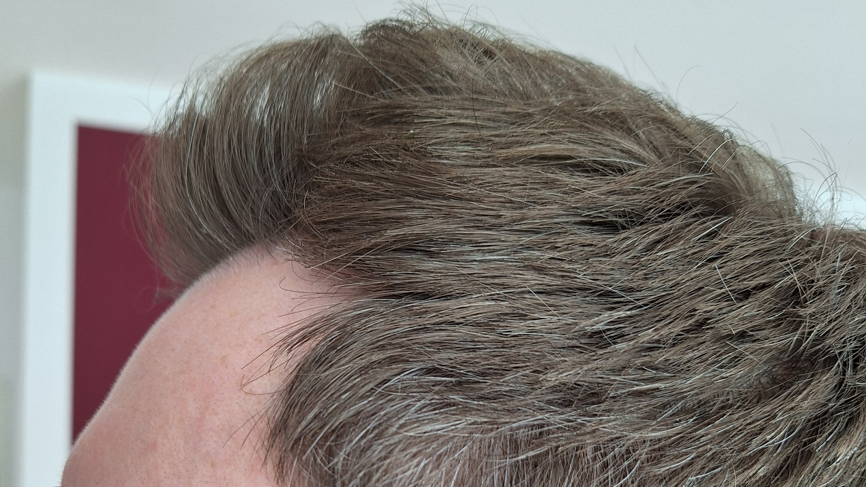 /foren/transplant/index.php/fa/67411/0/