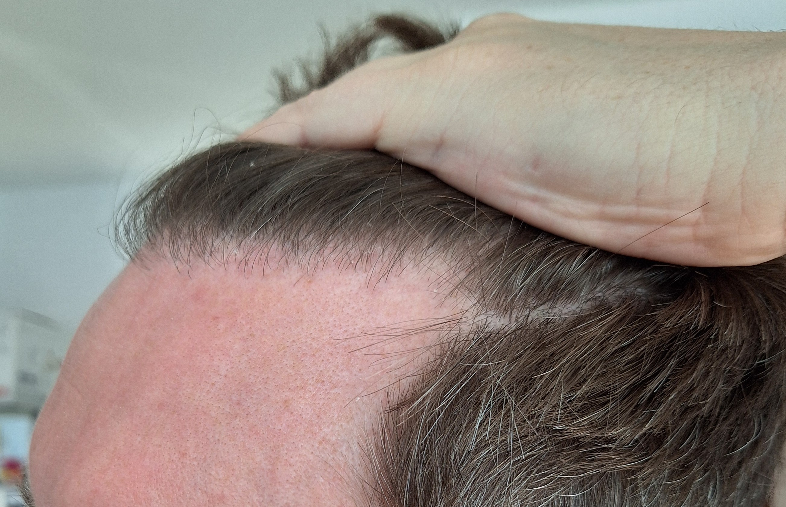 /foren/transplant/index.php/fa/67412/0/