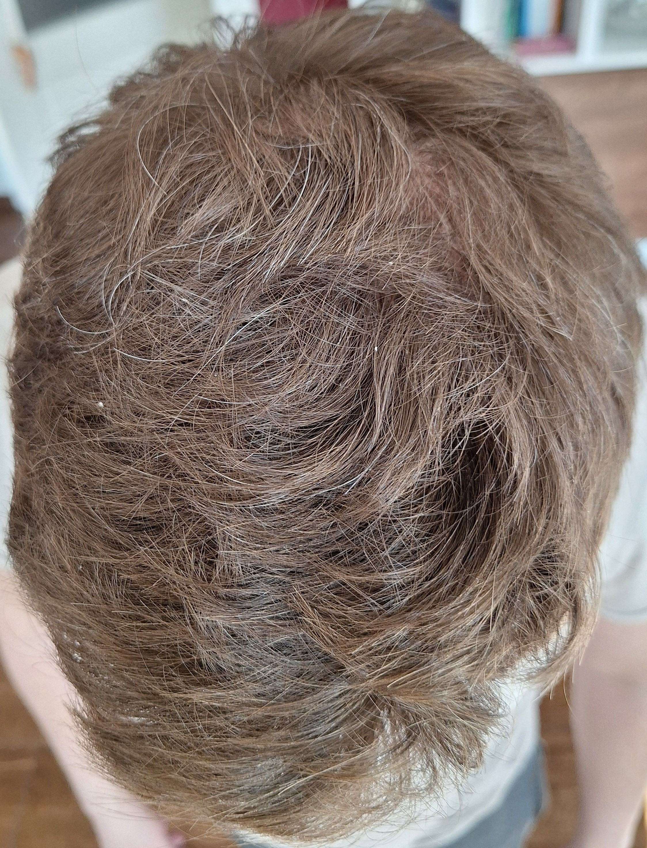 /foren/transplant/index.php/fa/67413/0/