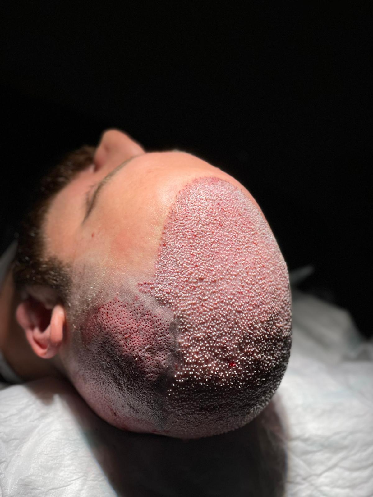 /foren/transplant/index.php/fa/67438/0/