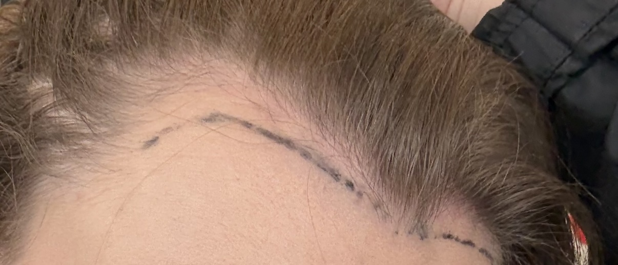 /foren/transplant/index.php/fa/67448/0/