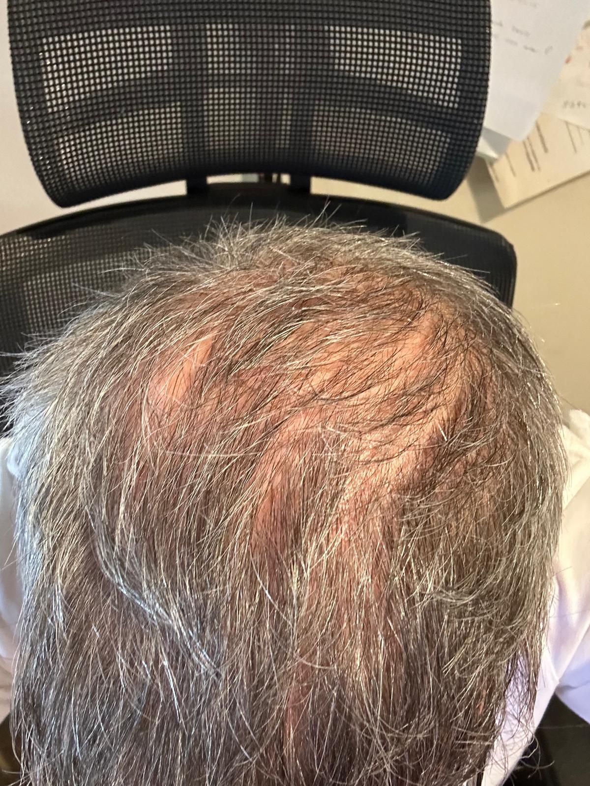 /foren/transplant/index.php/fa/67473/0/