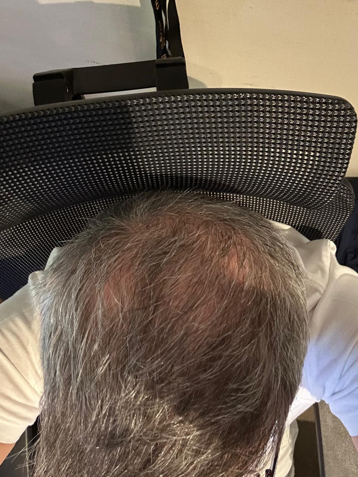 /foren/transplant/index.php/fa/67474/0/