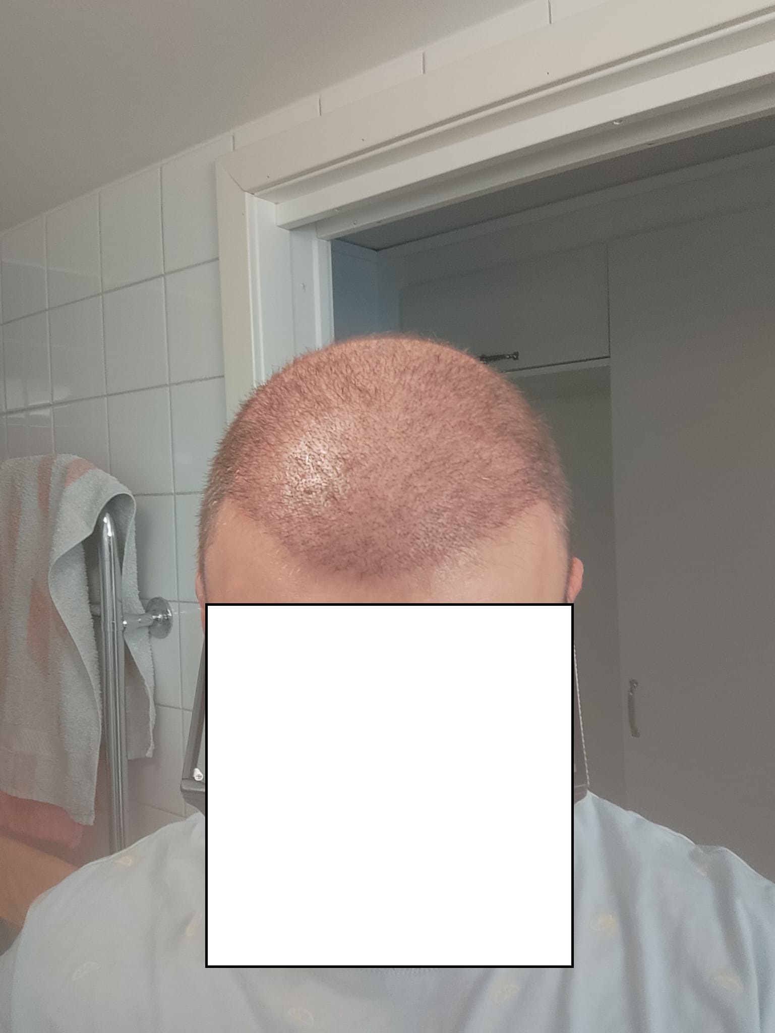 /foren/transplant/index.php/fa/67483/0/