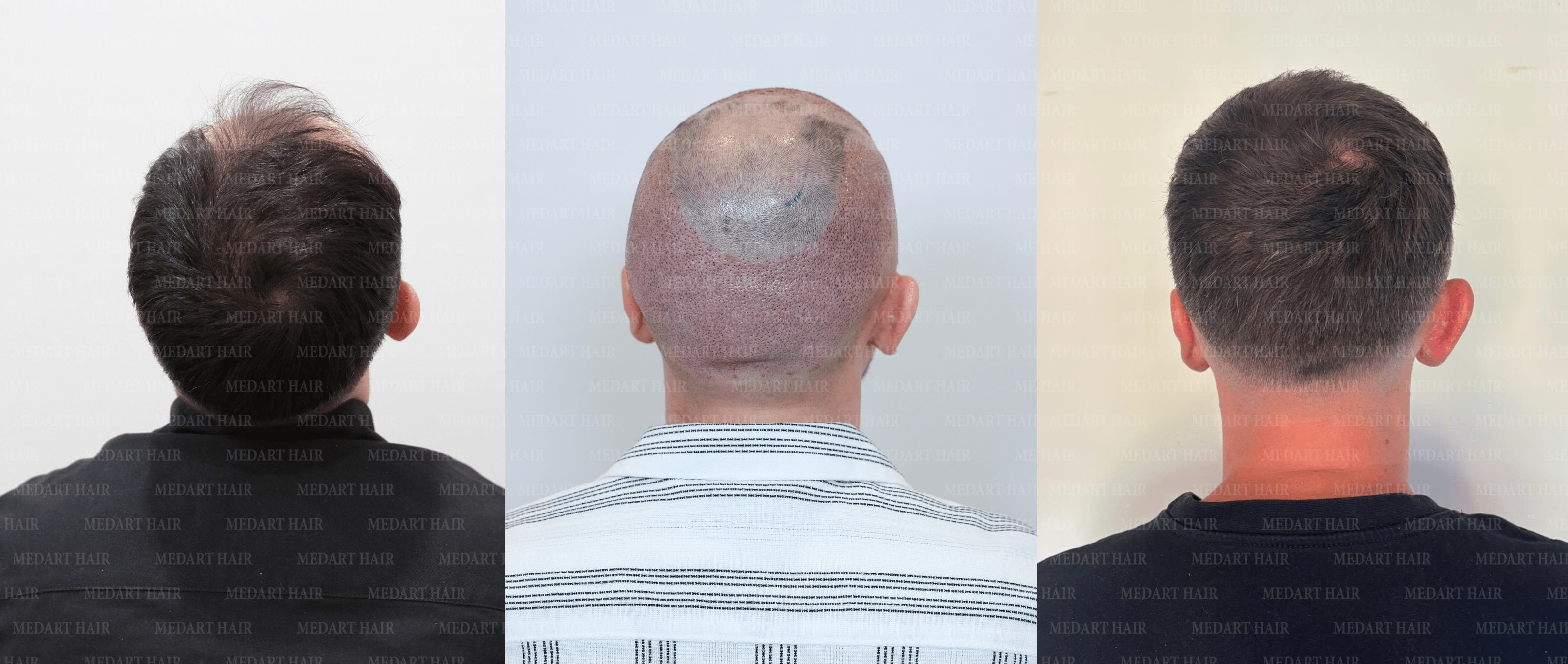 /foren/transplant/index.php/fa/67514/0/