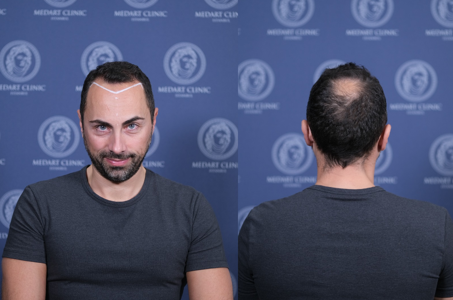 /foren/transplant/index.php/fa/67573/0/