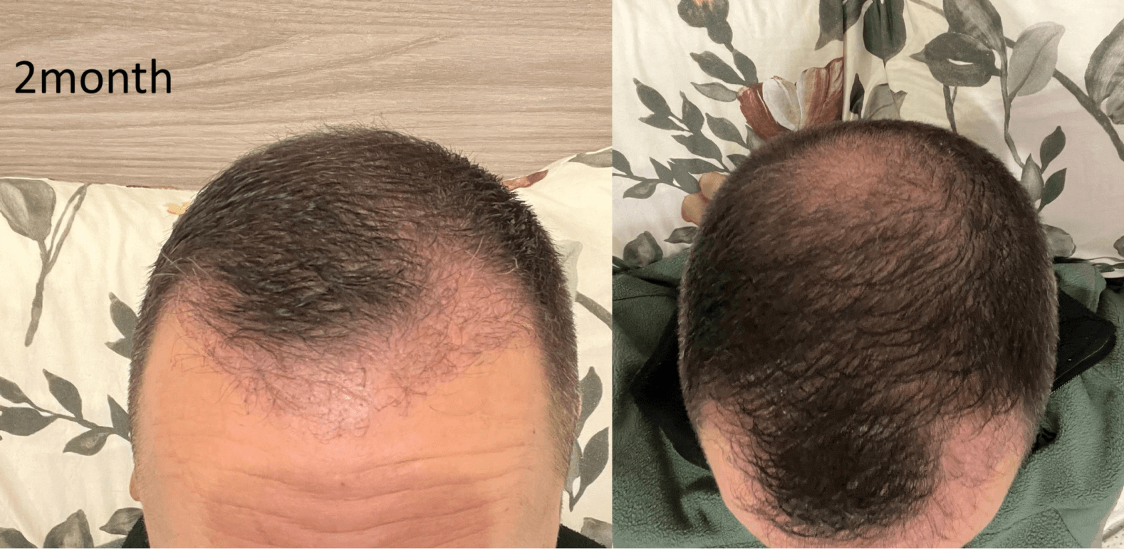 /foren/transplant/index.php/fa/67574/0/