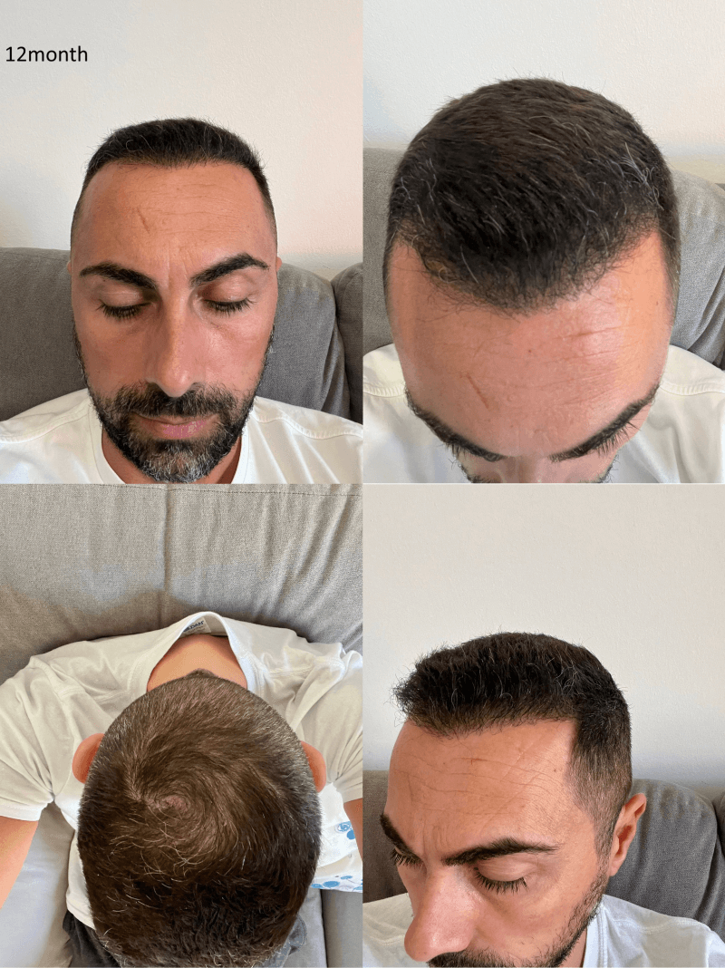 /foren/transplant/index.php/fa/67575/0/