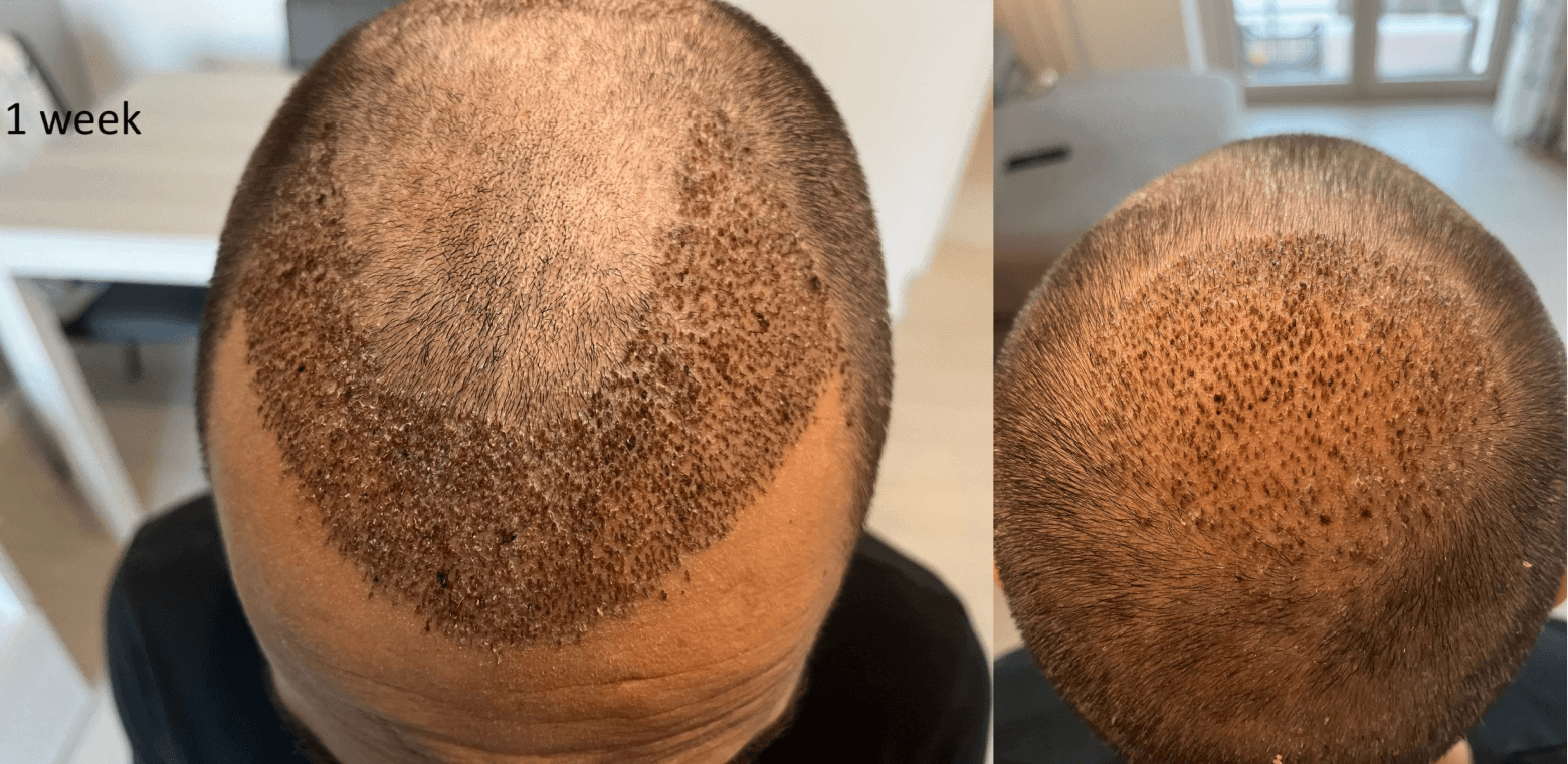 /foren/transplant/index.php/fa/67576/0/