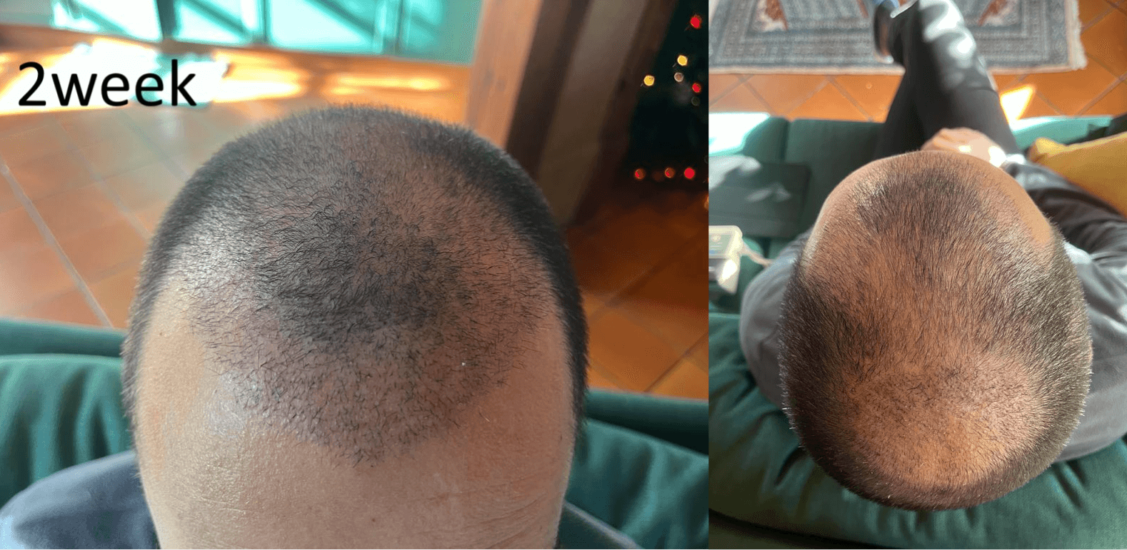 /foren/transplant/index.php/fa/67577/0/