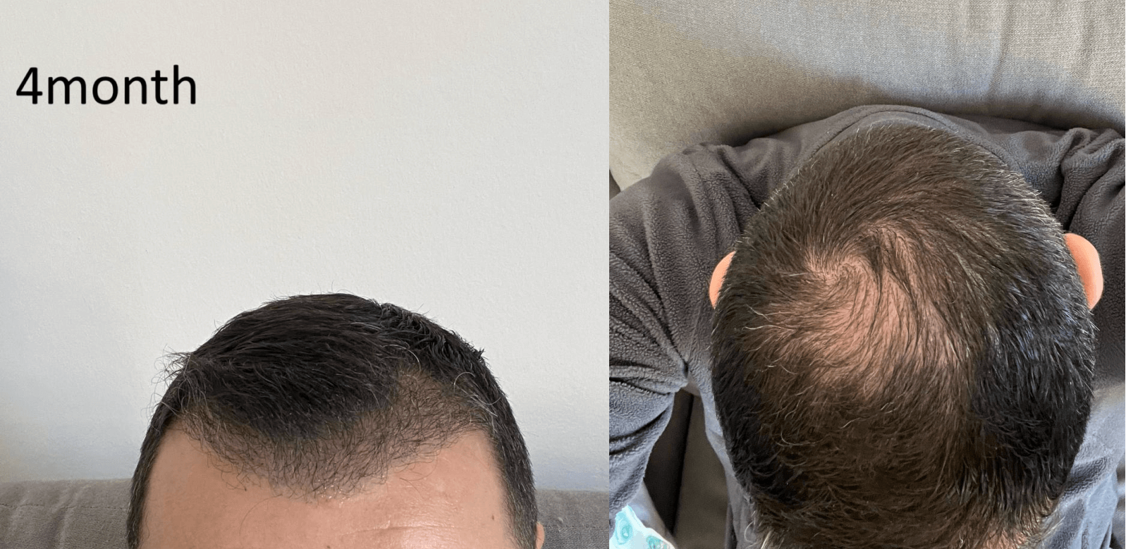 /foren/transplant/index.php/fa/67579/0/