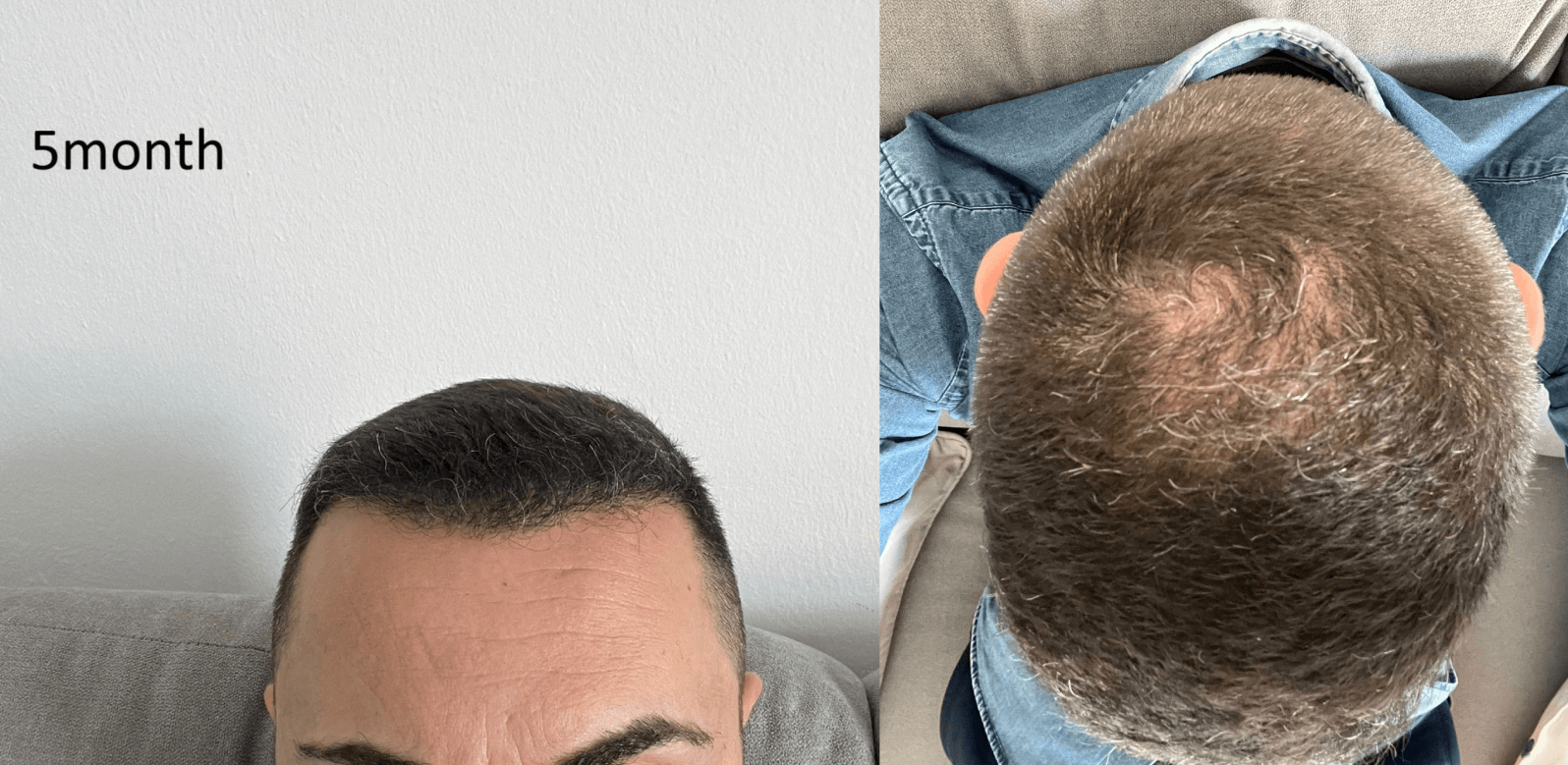 /foren/transplant/index.php/fa/67580/0/