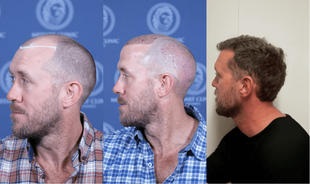 /foren/transplant/index.php/fa/67609/0/