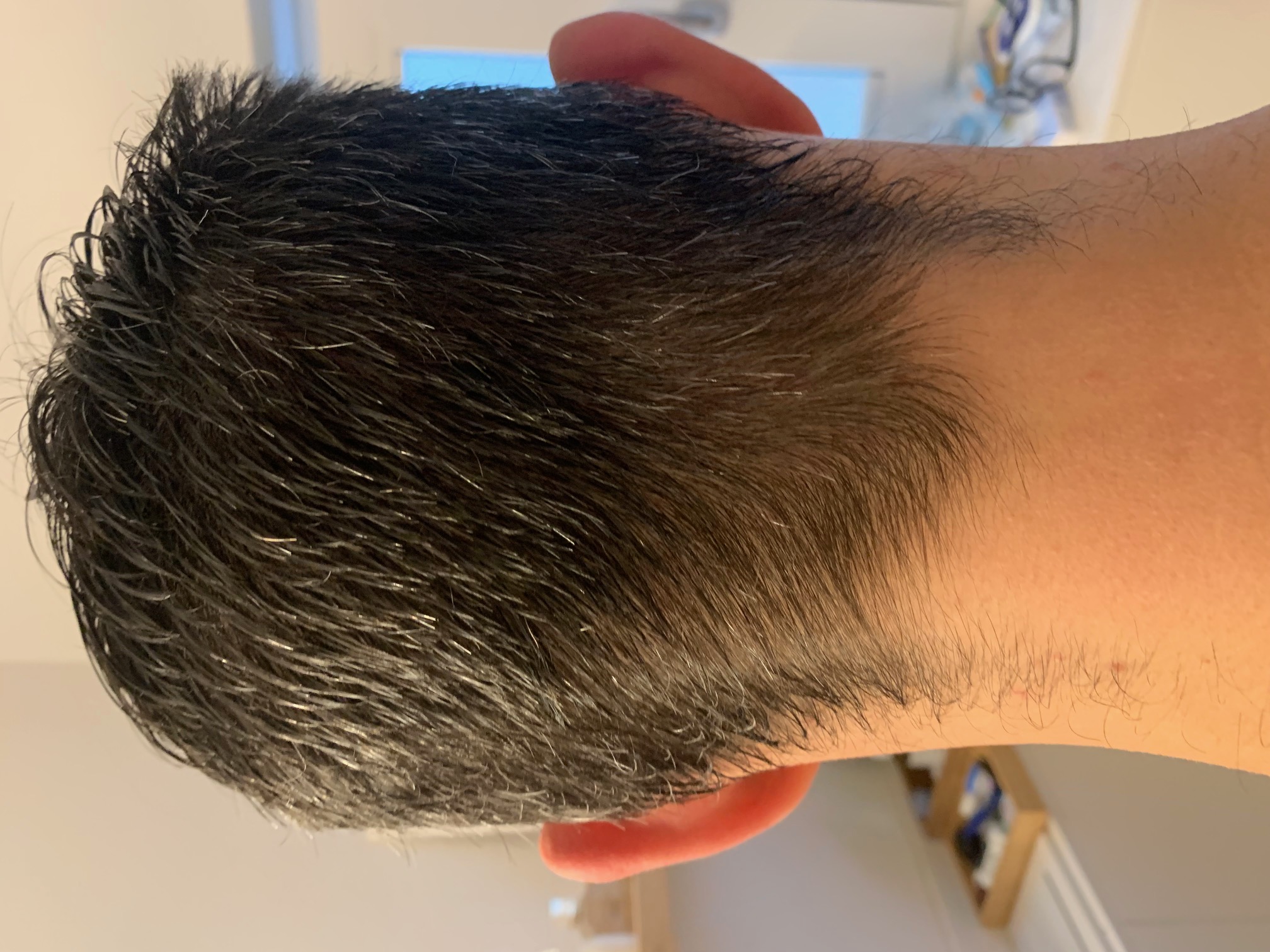 /foren/transplant/index.php/fa/67630/0/