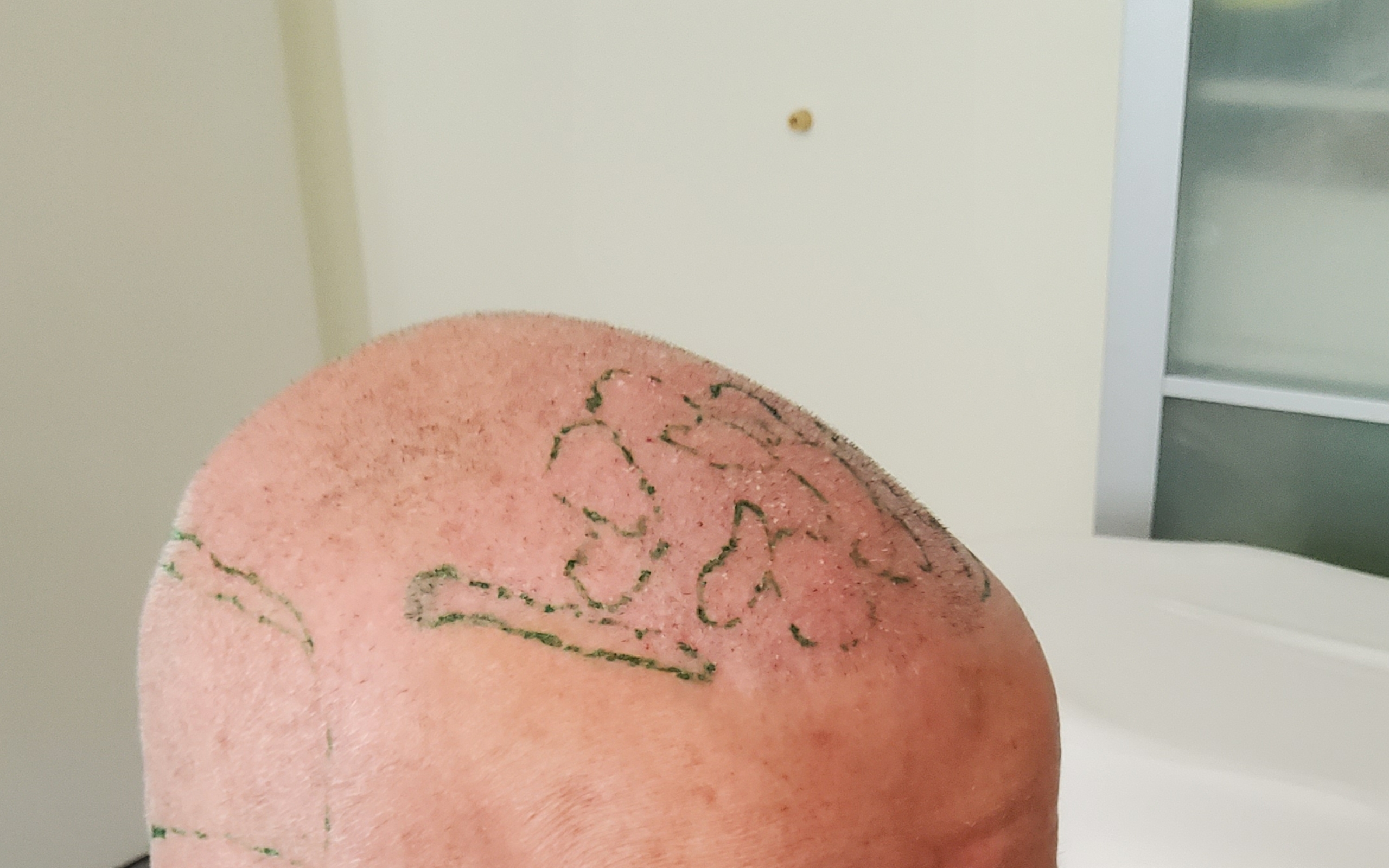 /foren/transplant/index.php/fa/67701/0/