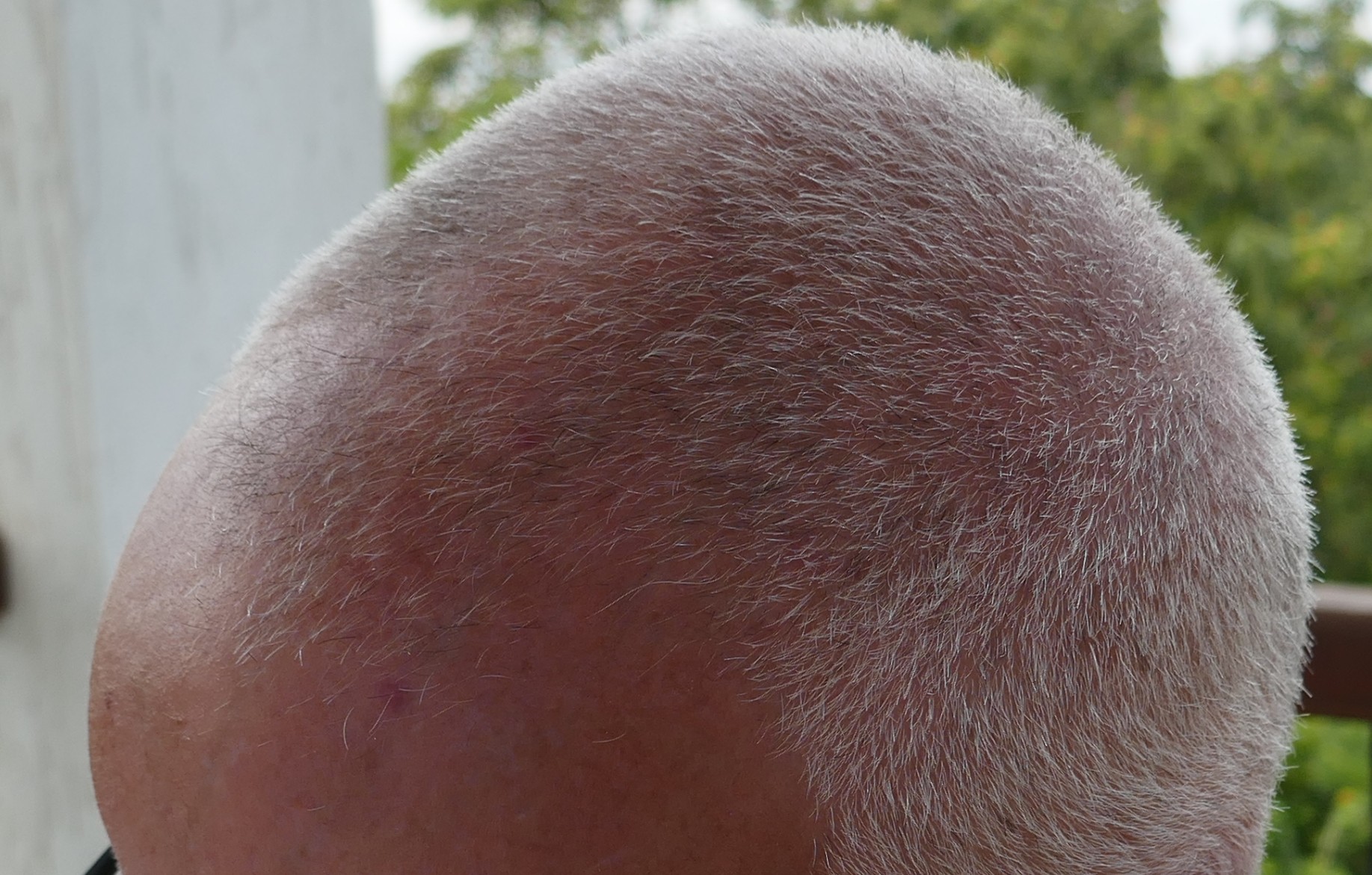 /foren/transplant/index.php/fa/67704/0/