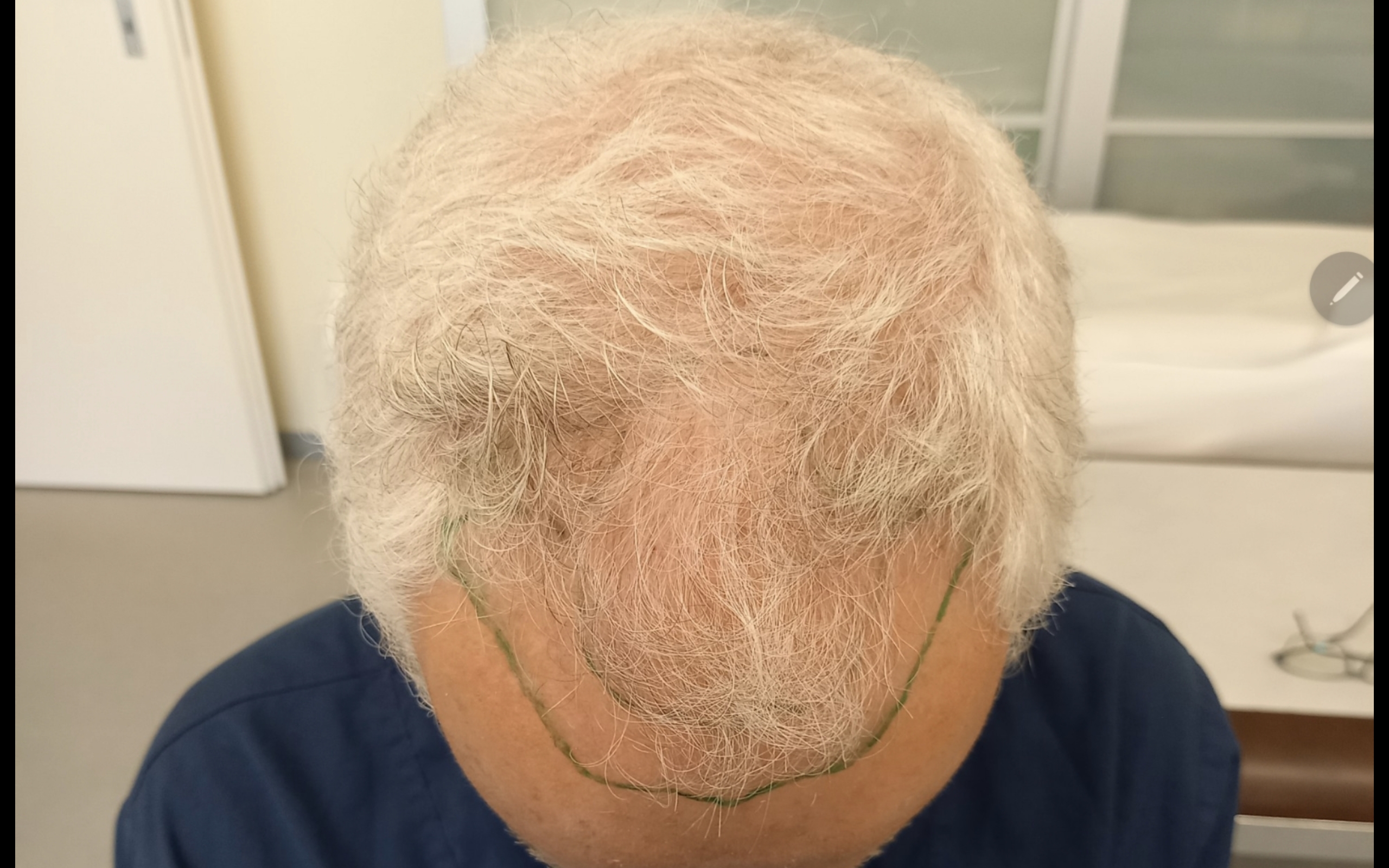 /foren/transplant/index.php/fa/67705/0/