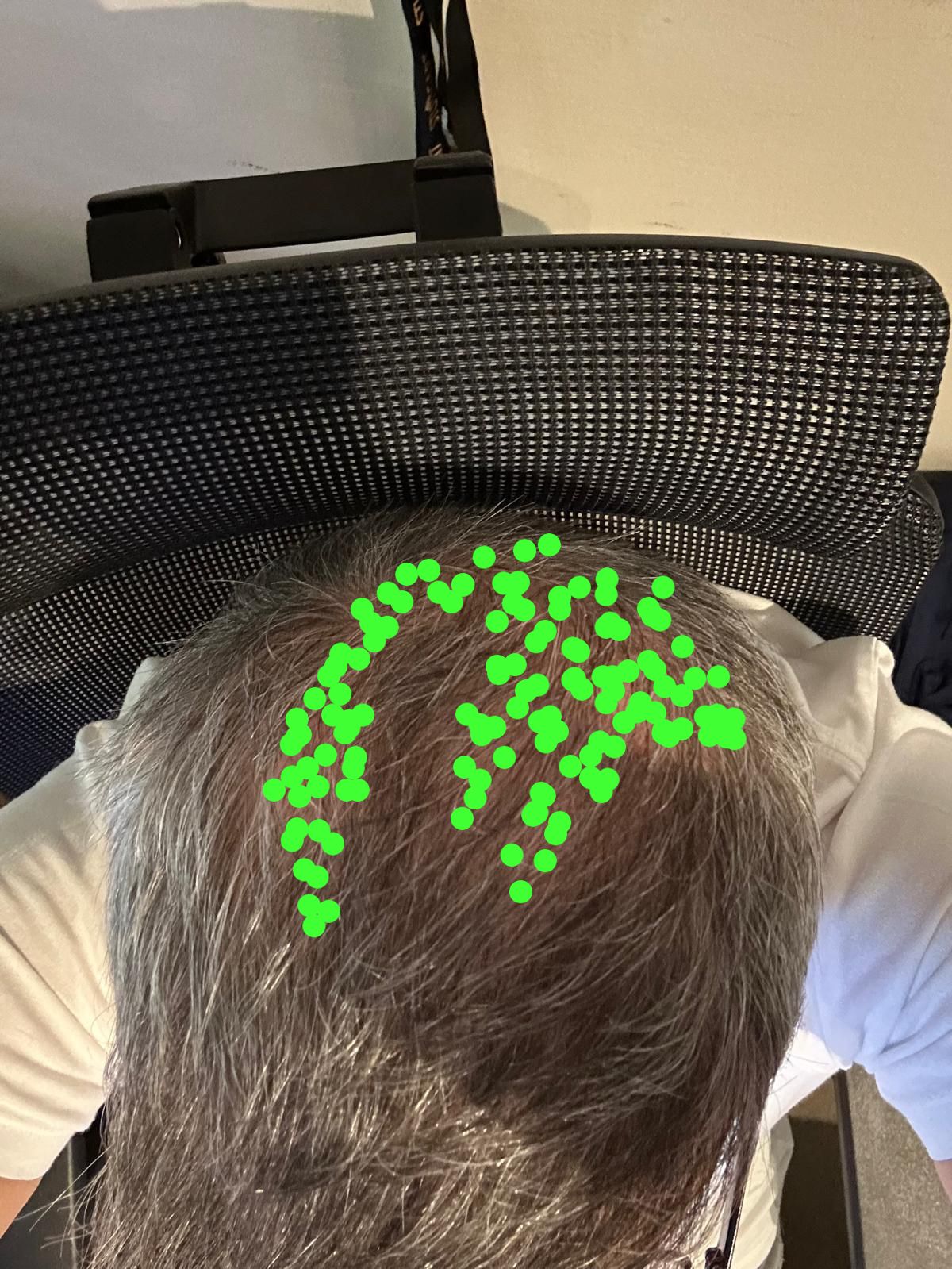 /foren/transplant/index.php/fa/67732/0/