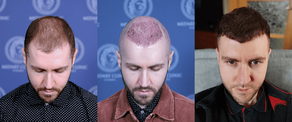 /foren/transplant/index.php/fa/67734/0/