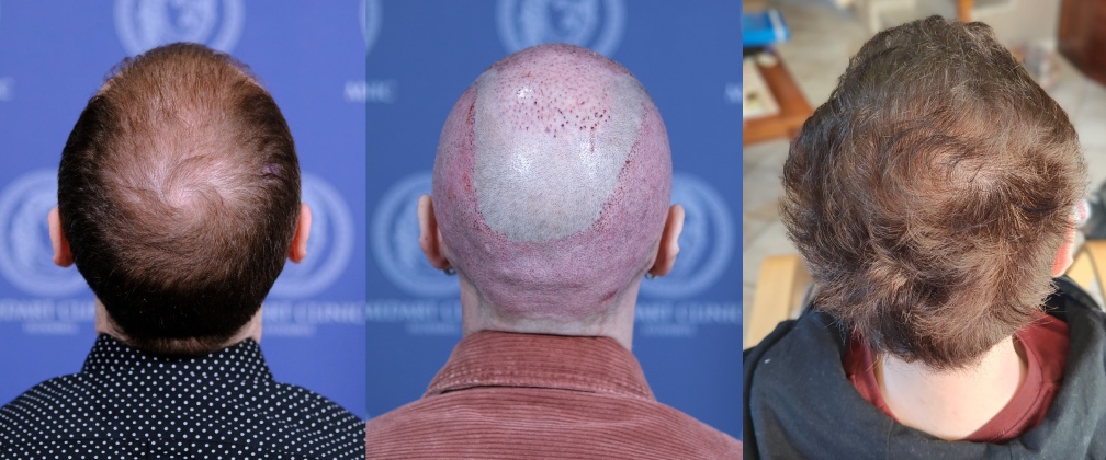 /foren/transplant/index.php/fa/67735/0/