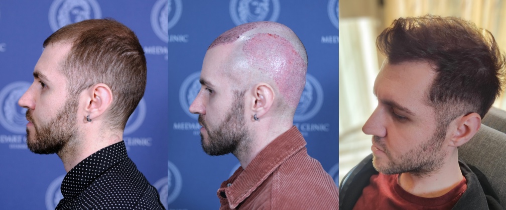 /foren/transplant/index.php/fa/67736/0/