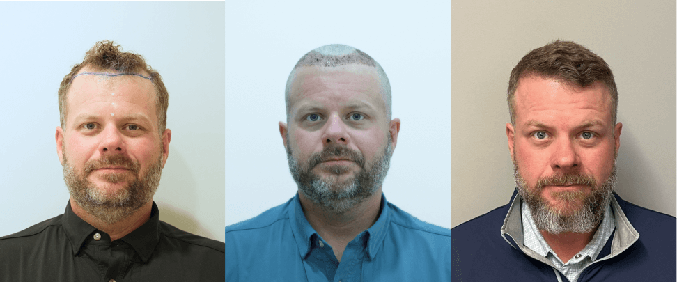 /foren/transplant/index.php/fa/67752/0/