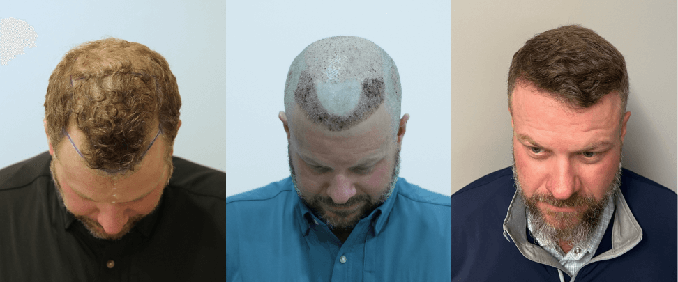 /foren/transplant/index.php/fa/67753/0/