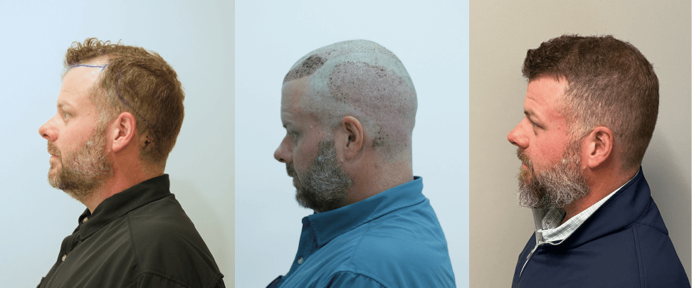 /foren/transplant/index.php/fa/67754/0/