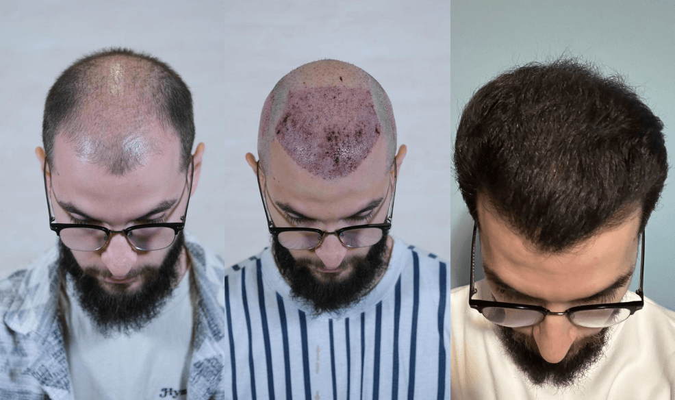 /foren/transplant/index.php/fa/67764/0/