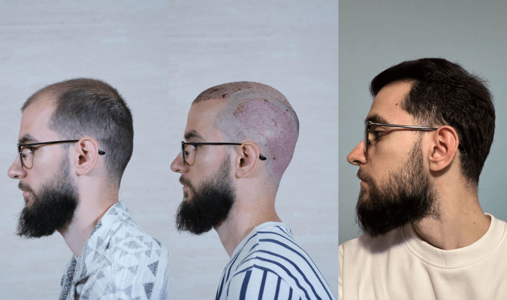 /foren/transplant/index.php/fa/67765/0/