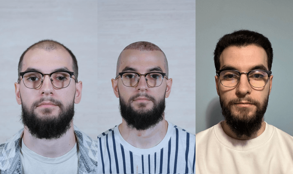 /foren/transplant/index.php/fa/67766/0/