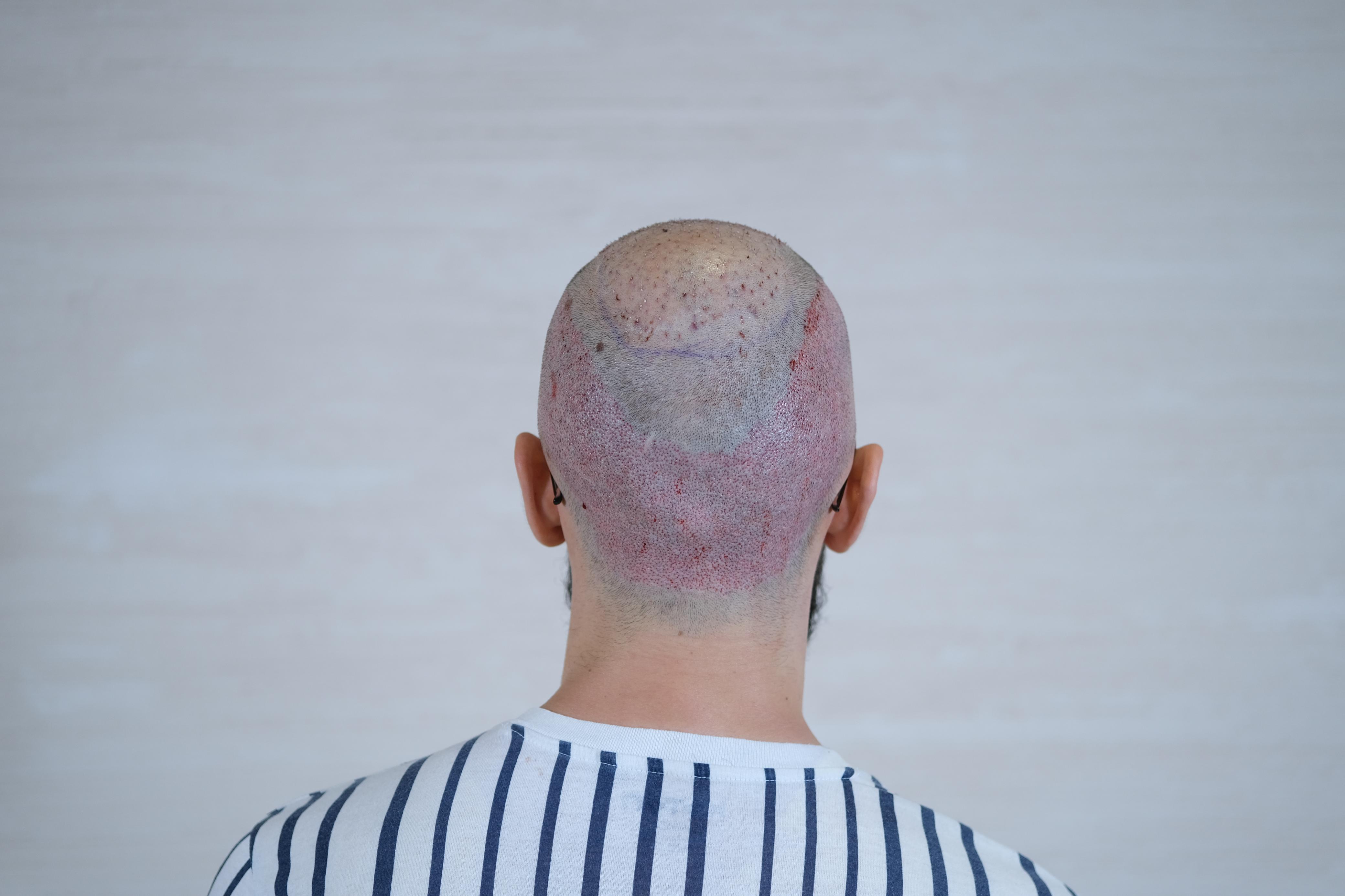 /foren/transplant/index.php/fa/67767/0/