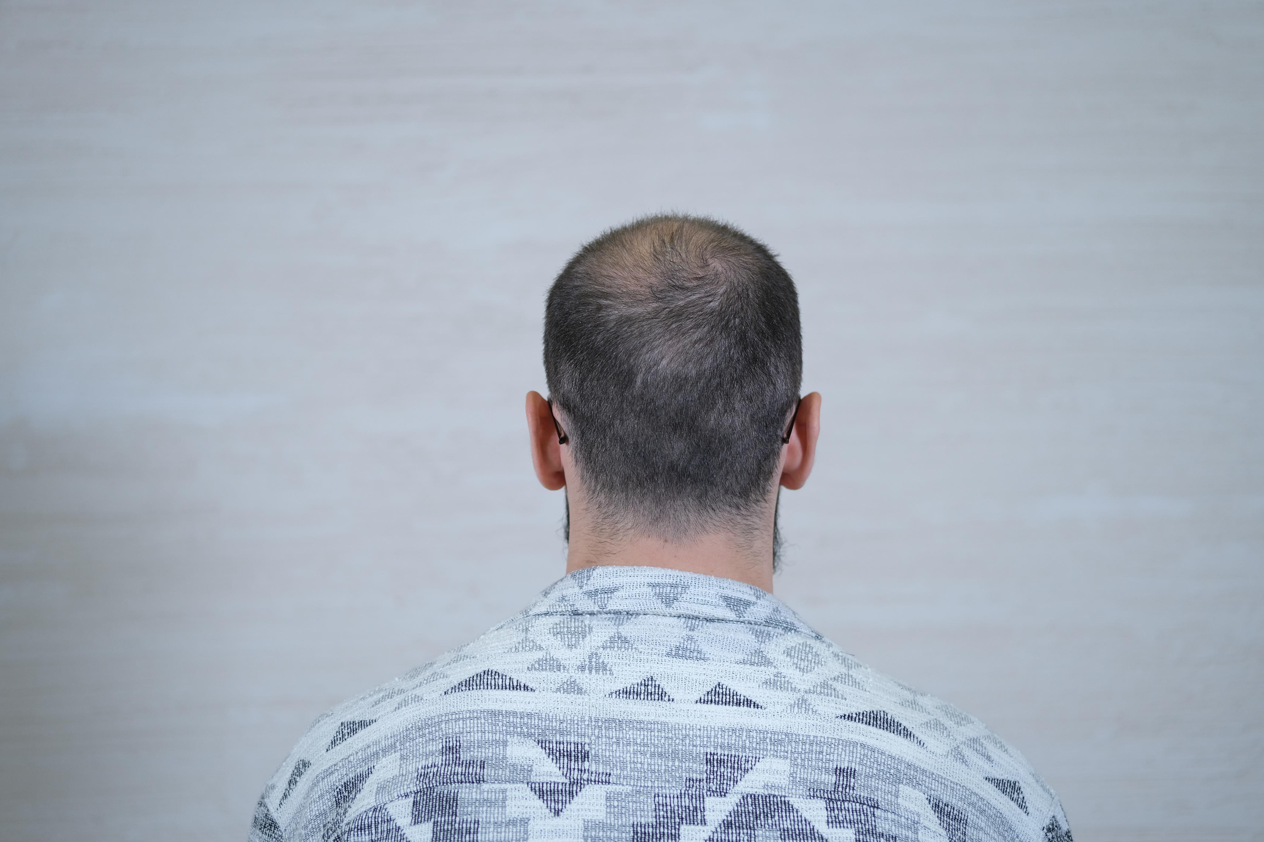 /foren/transplant/index.php/fa/67768/0/