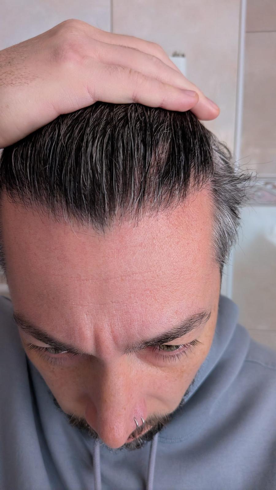 /foren/transplant/index.php/fa/67815/0/