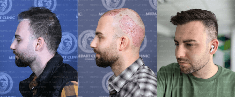 /foren/transplant/index.php/fa/67823/0/