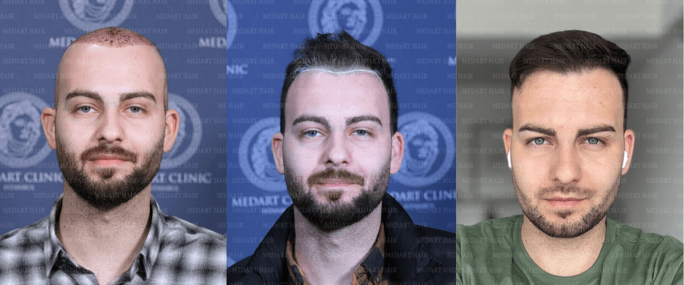 /foren/transplant/index.php/fa/67824/0/