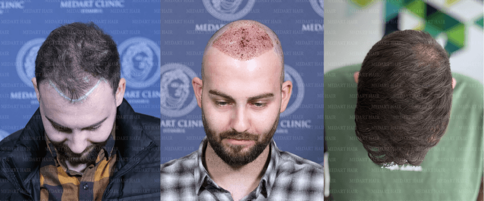 /foren/transplant/index.php/fa/67825/0/