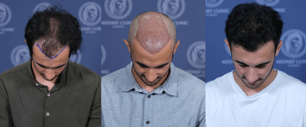 /foren/transplant/index.php/fa/67841/0/