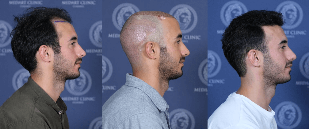 /foren/transplant/index.php/fa/67842/0/