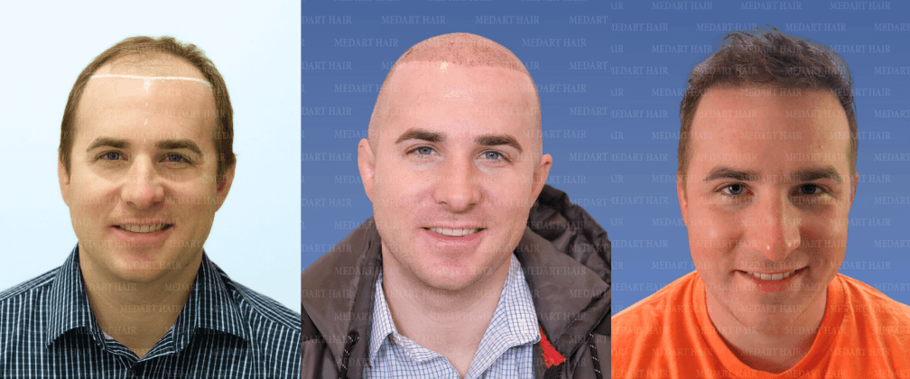 /foren/transplant/index.php/fa/67904/0/