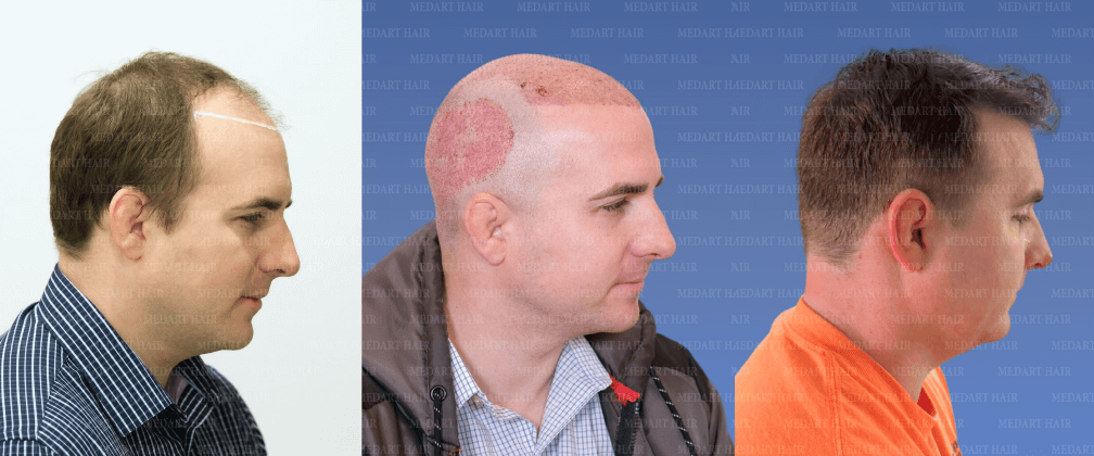 /foren/transplant/index.php/fa/67905/0/