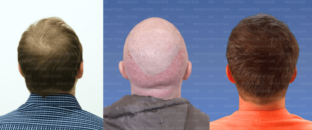 /foren/transplant/index.php/fa/67906/0/