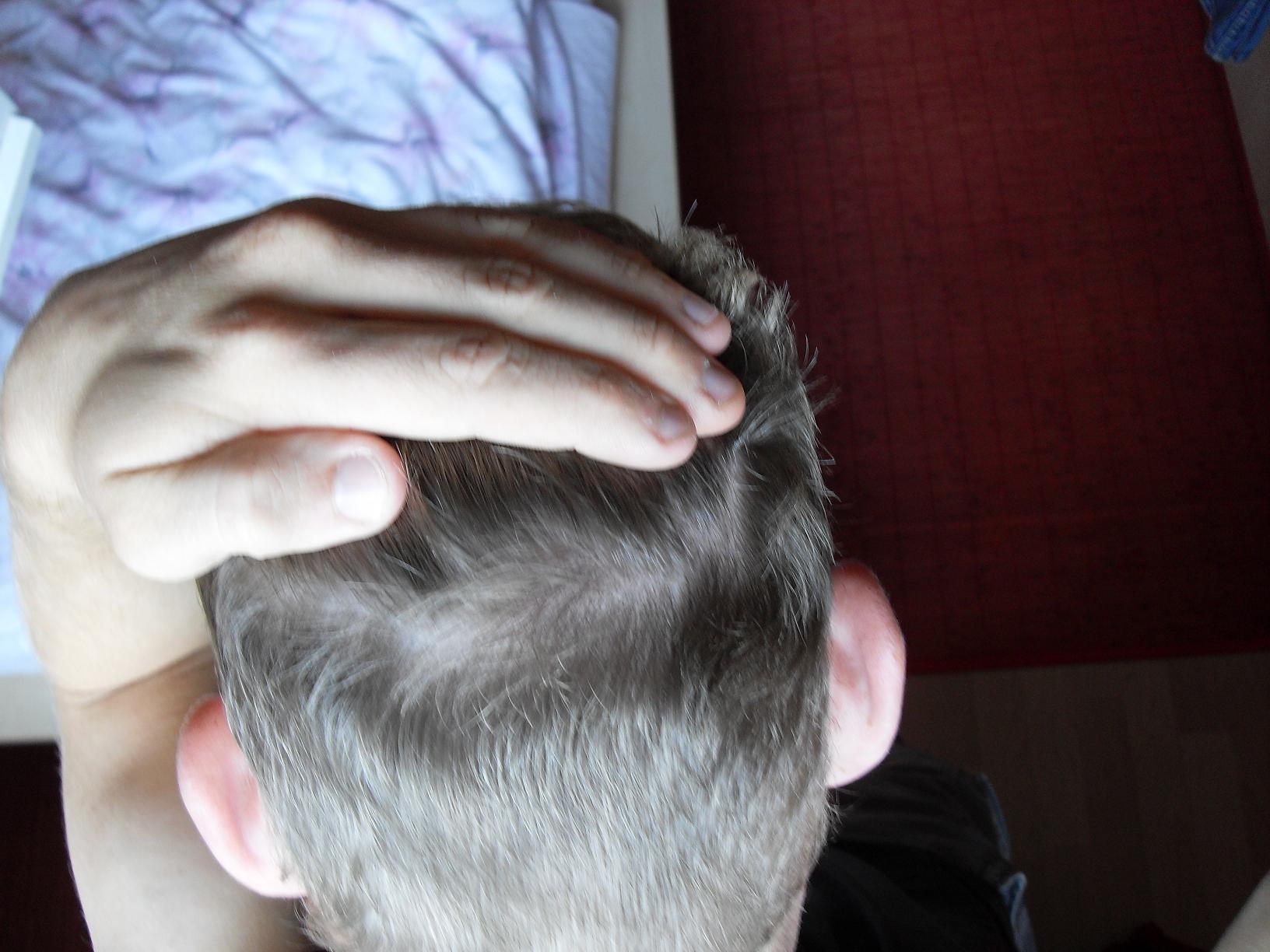 index.php/fa/6816/0/