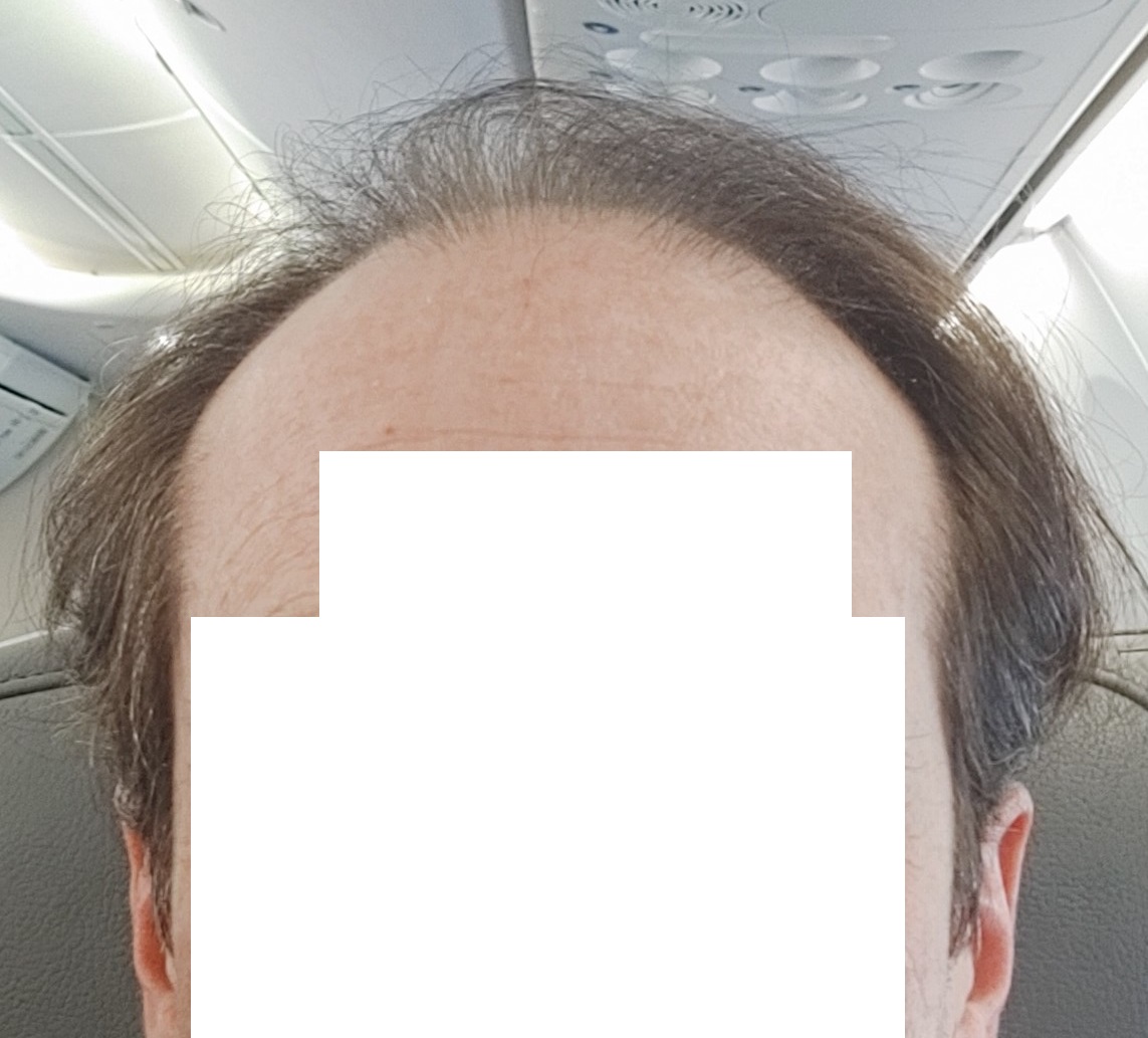 /foren/transplant/index.php/fa/68444/0/