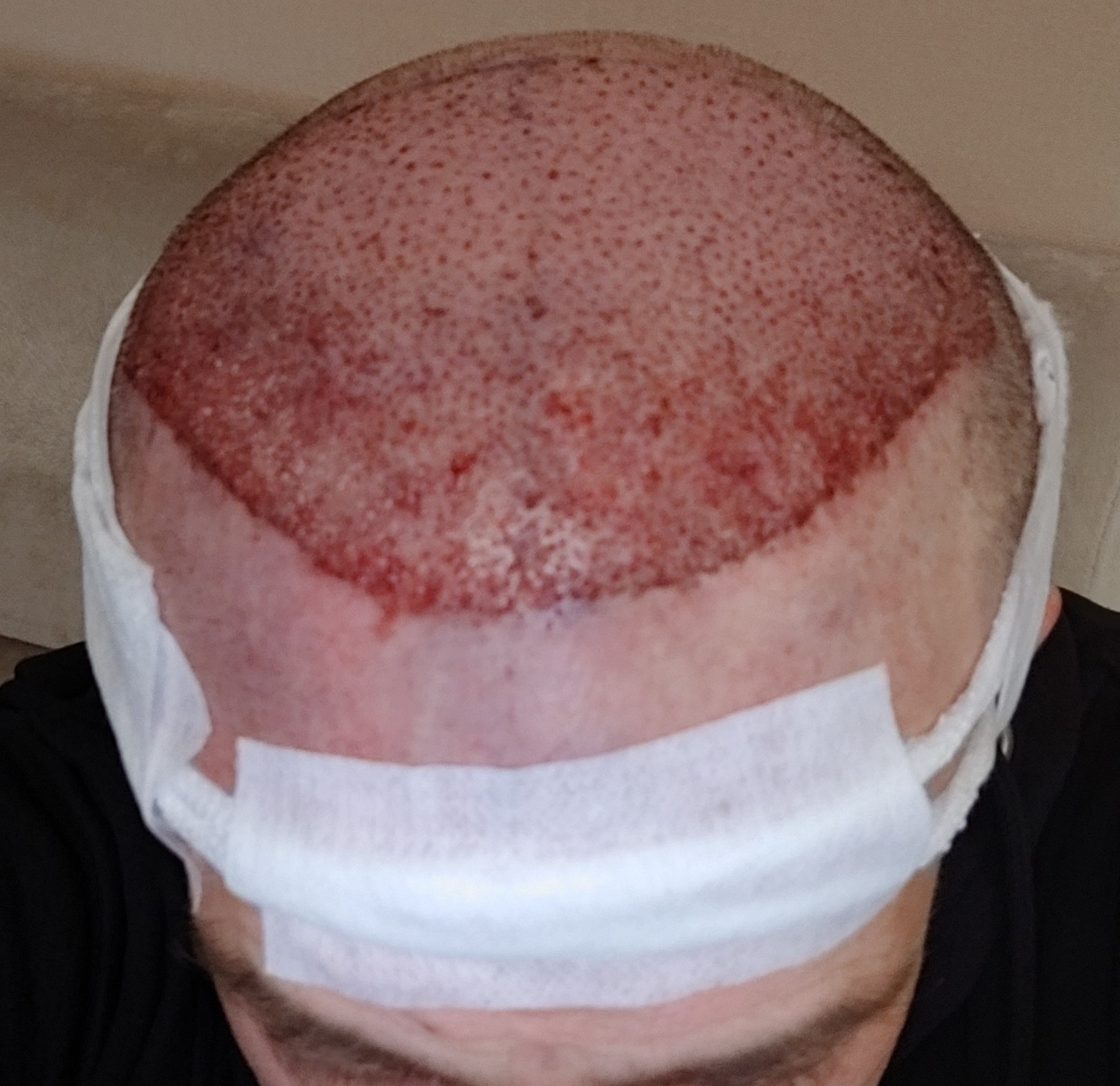 /foren/transplant/index.php/fa/68445/0/